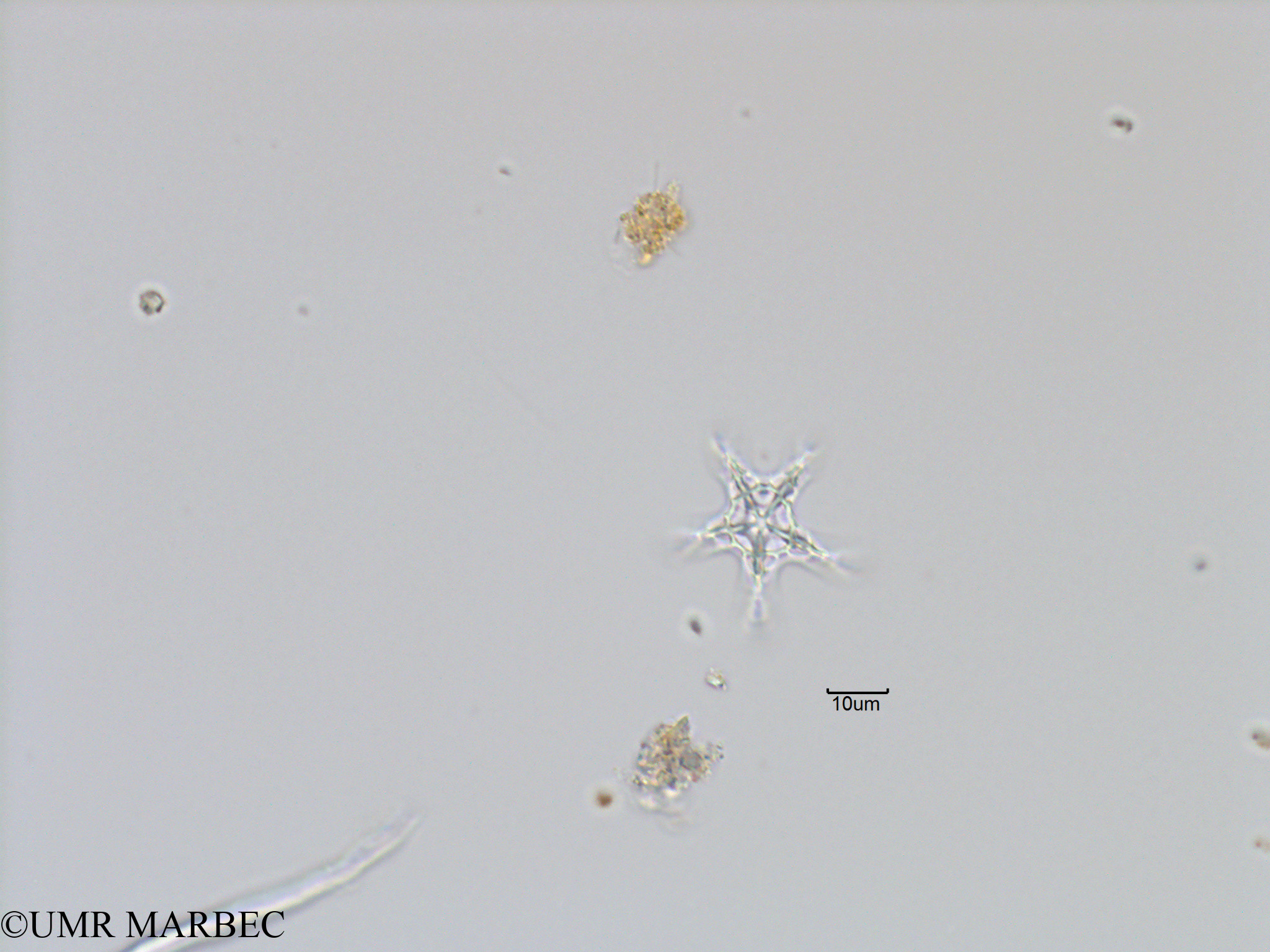 phyto/Bizerte/bizerte_bay/RISCO November 2015/Actiniscus pentasterias (Baie_T5-C1-Etoile-2).tif(copy).jpg